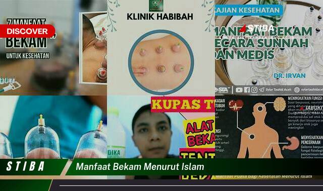 Ketahui 8 Manfaat Bekam Menurut Islam yang Wajib Kamu Ketahui