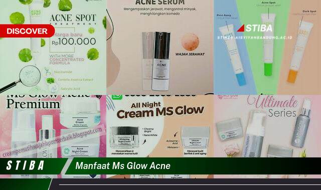 Temukan 9 Manfaat MS Glow Acne yang Jarang Diketahui Temukan 9 Manfaat MS Glow Acne yang Jarang Diketahui