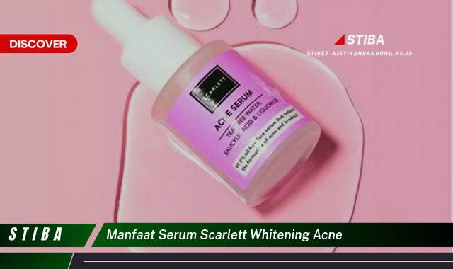 Ketahui 9 Manfaat Serum Scarlett Whitening Acne yang Bikin Kamu Penasaran